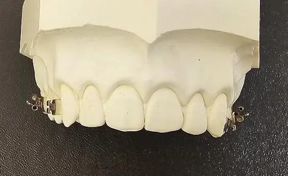 Natalie Yang Orthodontics – Vacaville Orthodontist